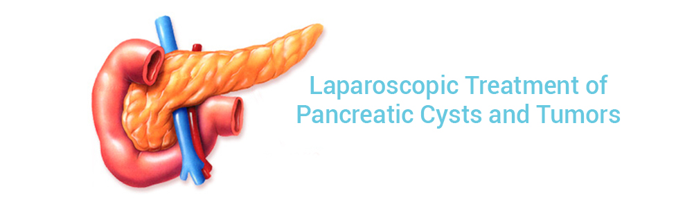 Pancreatic Surgery Digestive Surgery Cliinic
