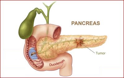 Pancreatic Surgery India 2015